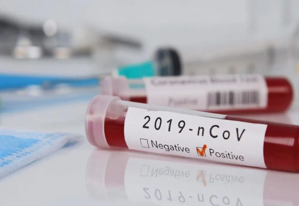 Peste 900 de cazuri de persoane infectate cu virusul COVID – 19  dintre care 8 în stare gravă, 13 persoane decedate (NAȚIONAL)