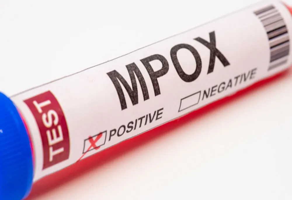 MPOX REPREZINTĂ ÎN CONTINUARE O URGENŢĂ DE SĂNĂTATE PUBLICĂ, A ANUNŢAT OMS