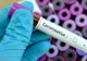 Alertă la Spitalul de Boli Infecțioase Iași! Nouă pacienți au fost confirmați pozitivi, dintre care doi sunt din Neamț