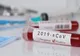 CORONAVIRUS: Situația în Neamț și în țară (date oficiale)