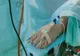 ALERTĂ MEDICALĂ: bărbat din Neamț, diagnosticat cu o boală infecţioasă rară