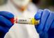 COVID-19, cifrele zilei. Câţi români s-au infectat, în ultimele 24 de ore